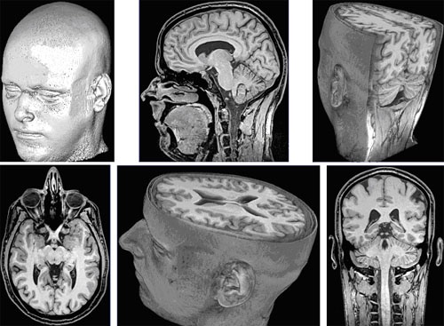 MRI Image 1