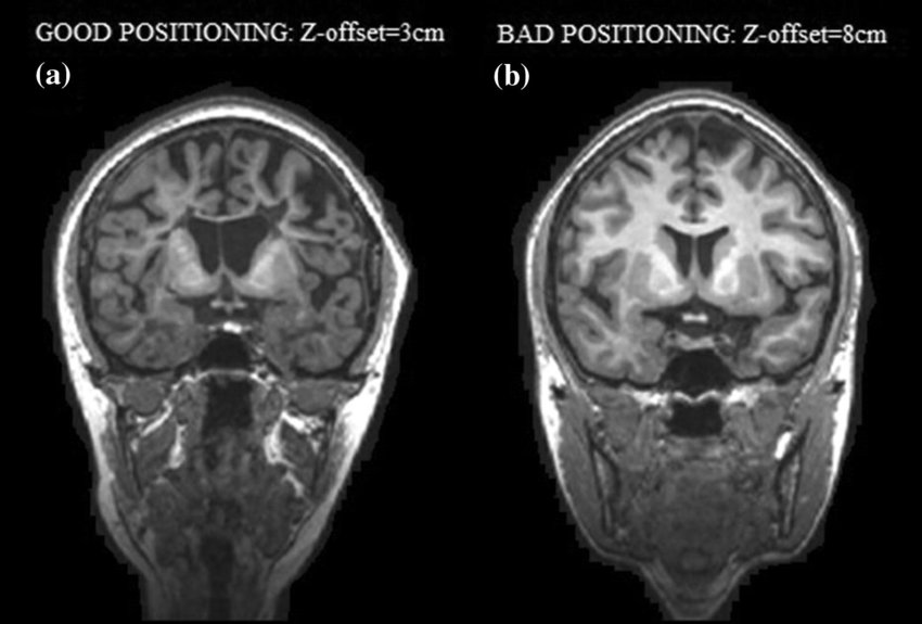 MRI Image 2