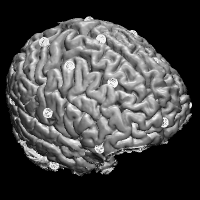 MRI Image 3